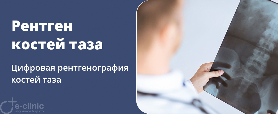 Рентген костей таза Рентген костей таза