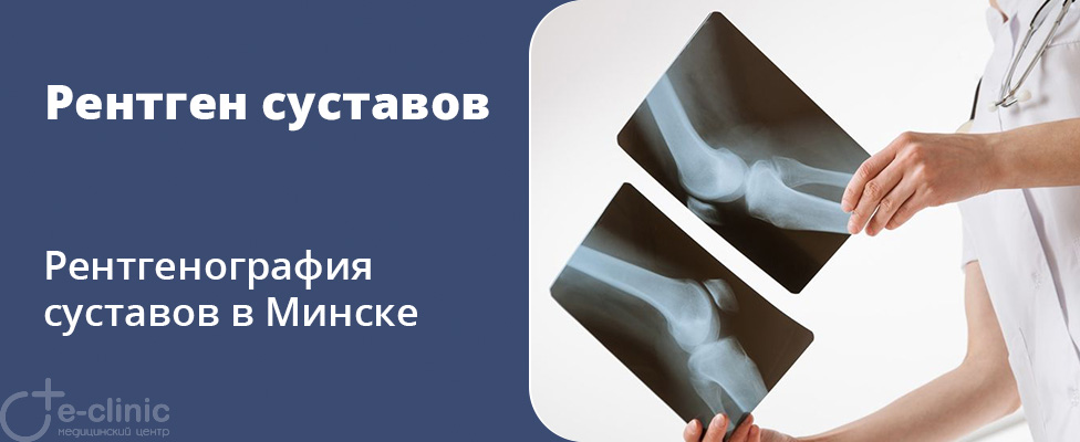 Рентген суставов Рентген суставов