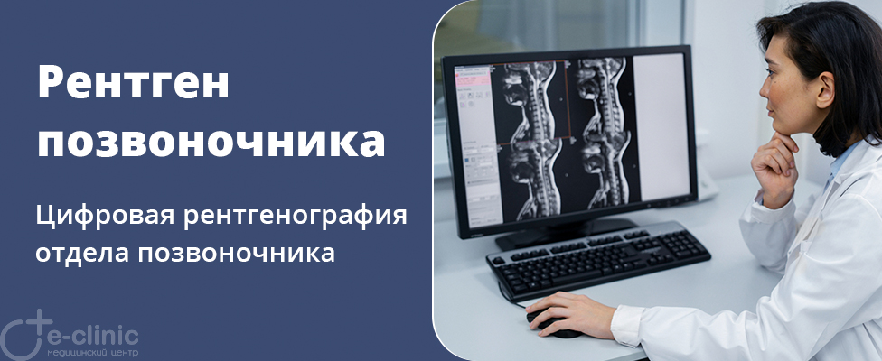 Рентген позвоночника Рентген позвоночника