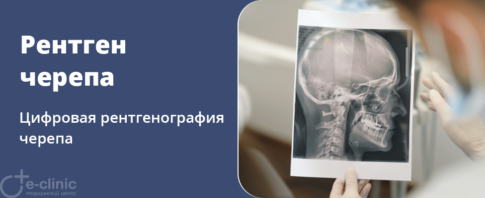 Рентген черепа Рентген черепа