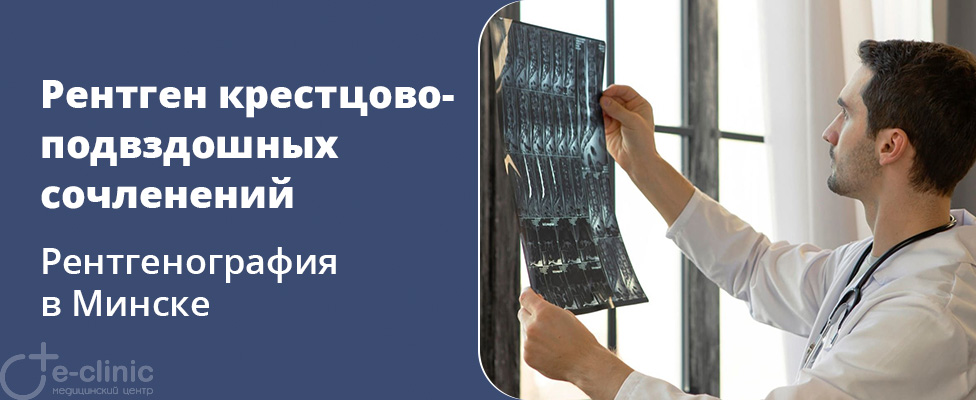 Рентген крестцово-подвздошных сочленений Рентген крестцово-подвздошных сочленений