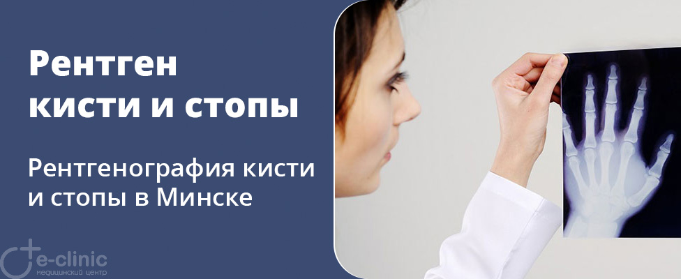 Рентген кисти и стопы Рентген кисти и стопы