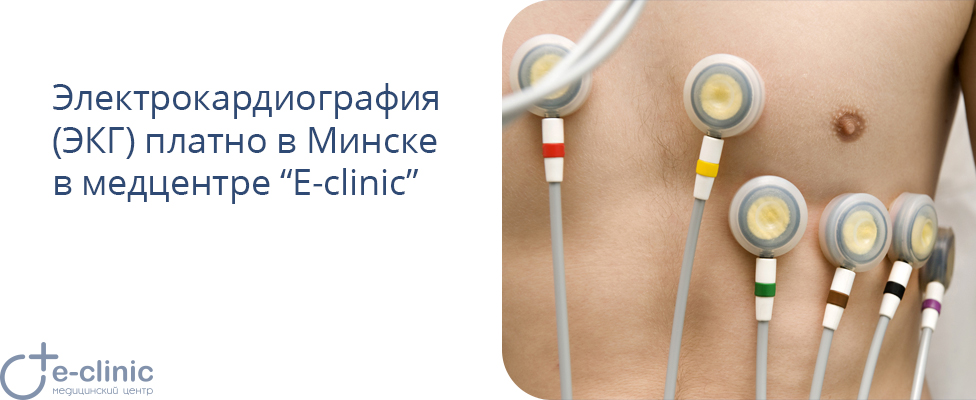 Сделать ЭКГ Минск платно